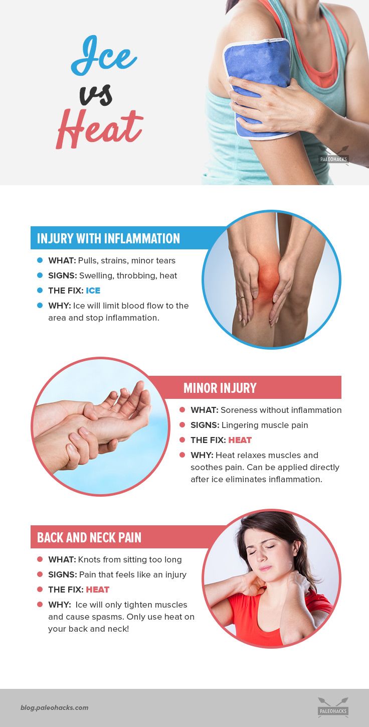 ice or heat for muscle pain