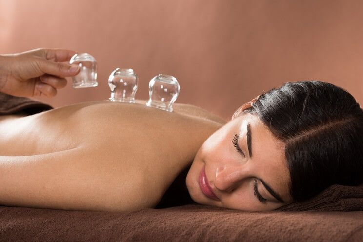 woman receiving cupping therapy