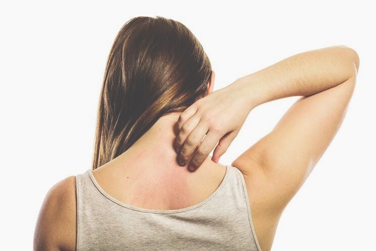 Woman scratching a rash