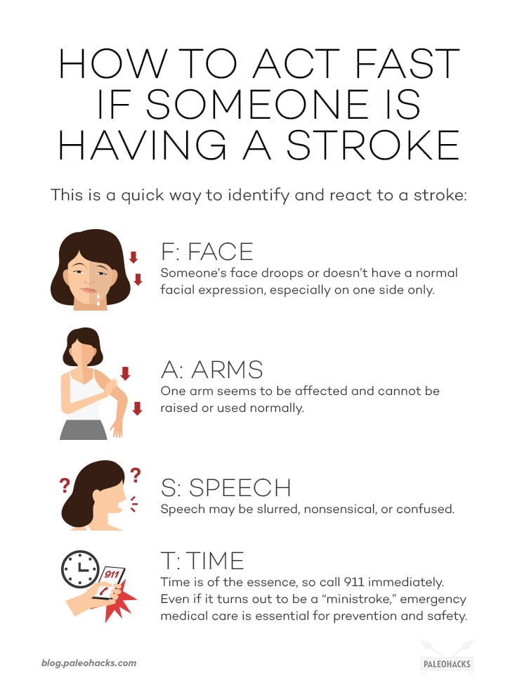 Knowing the signs of a stroke could help save a life. Here are the 10 telltale signs of a stroke, and what to do immediately.